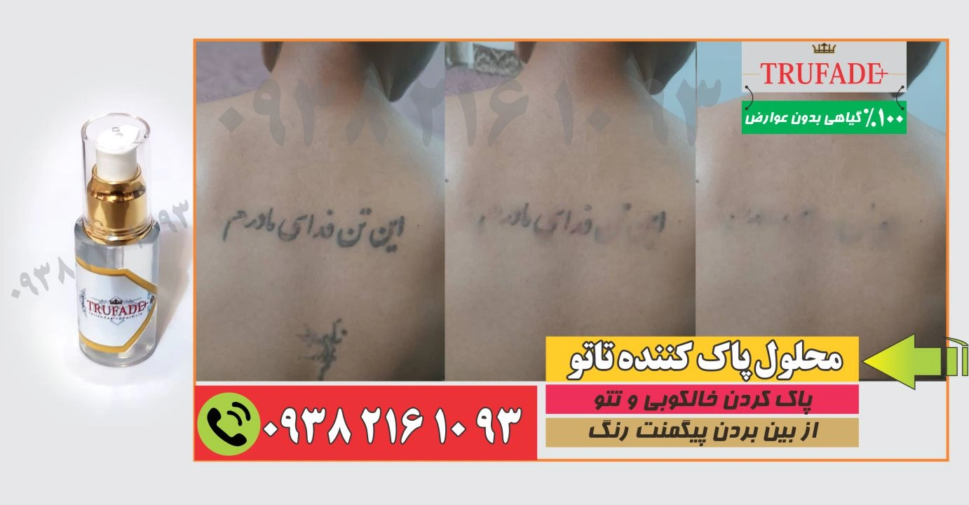 قویترین پاک کننده تاتو