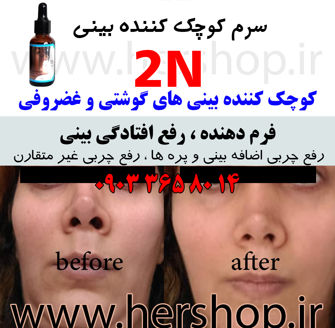 سرم کوچک کننده بینی 2n