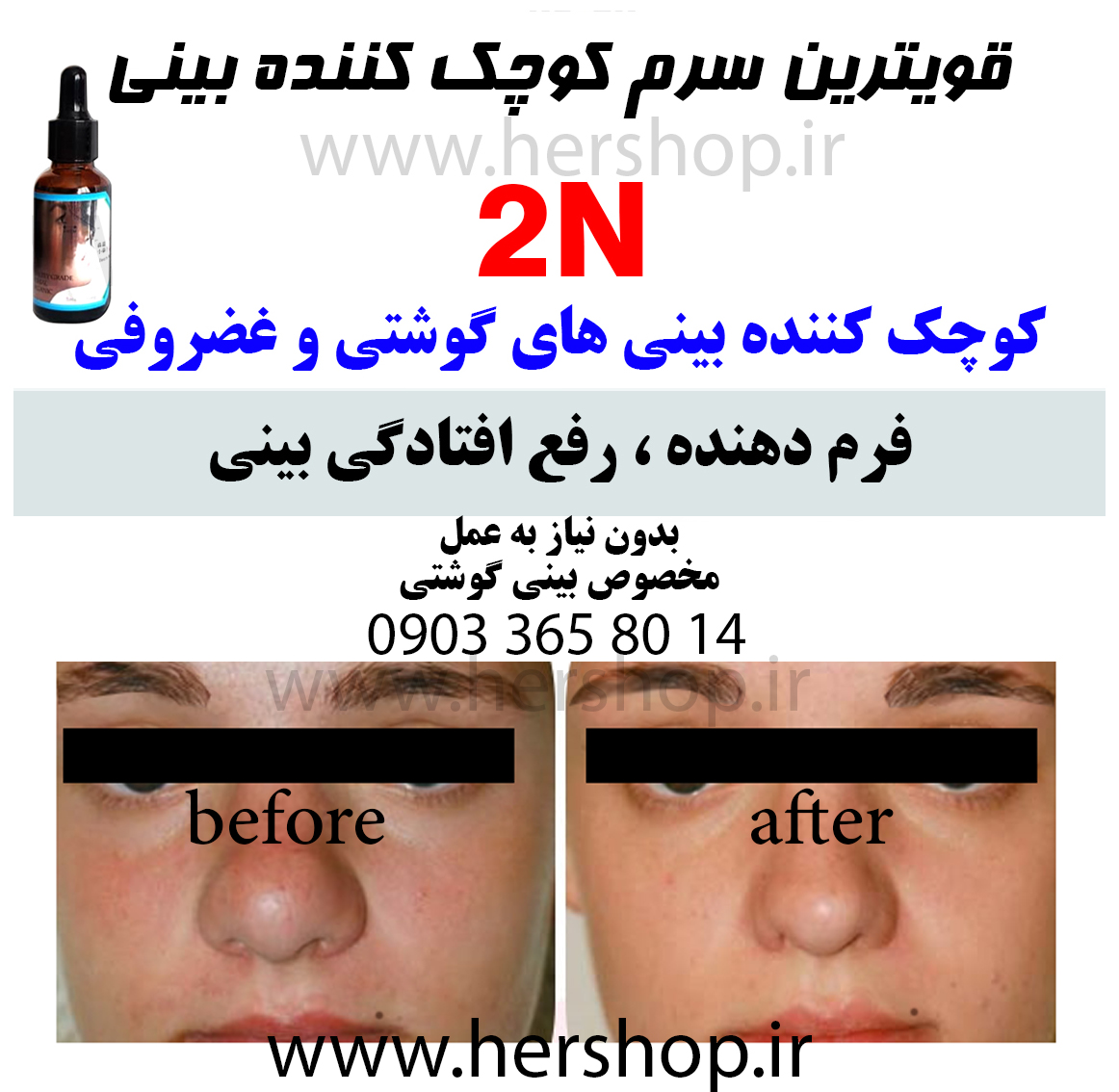 کوچک کننده بینی سرم قوی