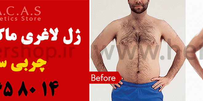 فروش-ژل-لاغری-ماکاس-سوئیسی